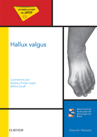 صورة الغلاف: Hallux valgus 9782294750663