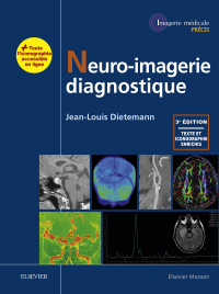 Imagen de portada: Neuro-imagerie diagnostique 3rd edition 9782294753947