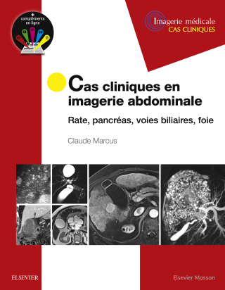 Cover image: Cas cliniques en imagerie abdominale 9782294753121