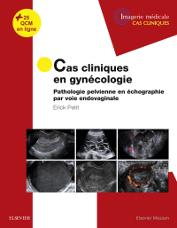 Immagine di copertina: Cas cliniques en imagerie : gynécologie 9782294755514