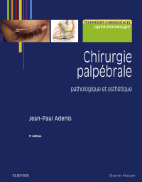 Cover image: Chirurgie palpébrale 2nd edition 9782294756382