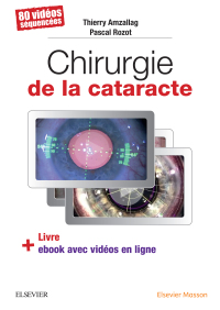 Cover image: Chirurgie de la cataracte 9782294757372