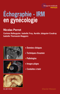 Cover image: Echographie - IRM en gynécologie 9782294757310