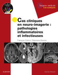 Imagen de portada: Cas cliniques en neuro-imagerie : pathologies inflammatoires et infectieuses 9782294758508