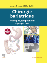 Cover image: Chirurgie bariatrique 9782294758799