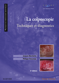 Cover image: La colposcopie 4th edition 9782294759642