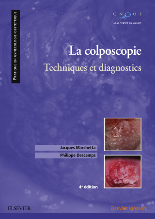 Cover image: La colposcopie 4th edition 9782294759642