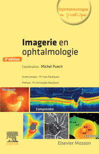 Omslagafbeelding: Imagerie en ophtalmologie 2nd edition 9782294760167