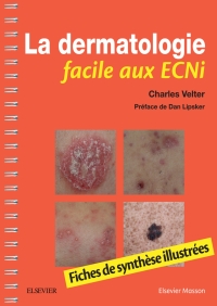 Omslagafbeelding: La dermatologie facile aux ECNi 9782294759703
