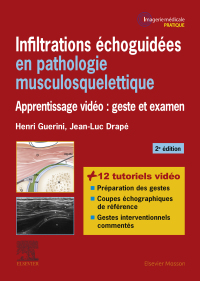 Titelbild: Infiltrations échoguidées en pathologie musculosquelettique 2nd edition 9782294759987