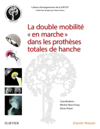 Titelbild: La double mobilité en marche dans les prothèses totales de hanche 9782294760655