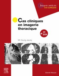 Cover image: Cas cliniques en imagerie thoracique 9782294759673