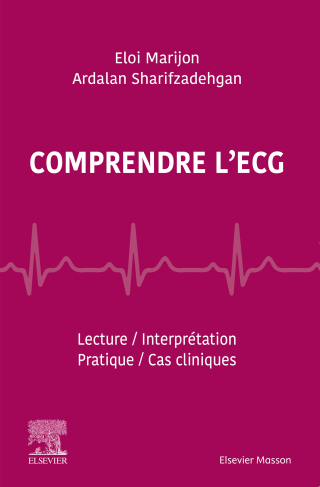 Cover image: Comprendre l'ECG 9782294761294