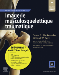 Cover image: Imagerie musculosquelettique traumatique 9782294760402