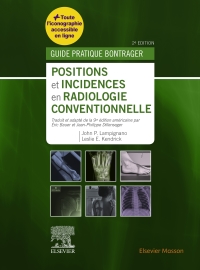 表紙画像: Positions et incidences en radiologie conventionnelle 2nd edition 9782294760341