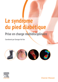 Titelbild: Le syndrome du pied diabétique 9782294762437