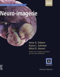 Cover image: Neuro-imagerie 9782294761355