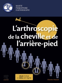 صورة الغلاف: L'arthroscopie de la cheville et de l'arrière-pied 9782294766626