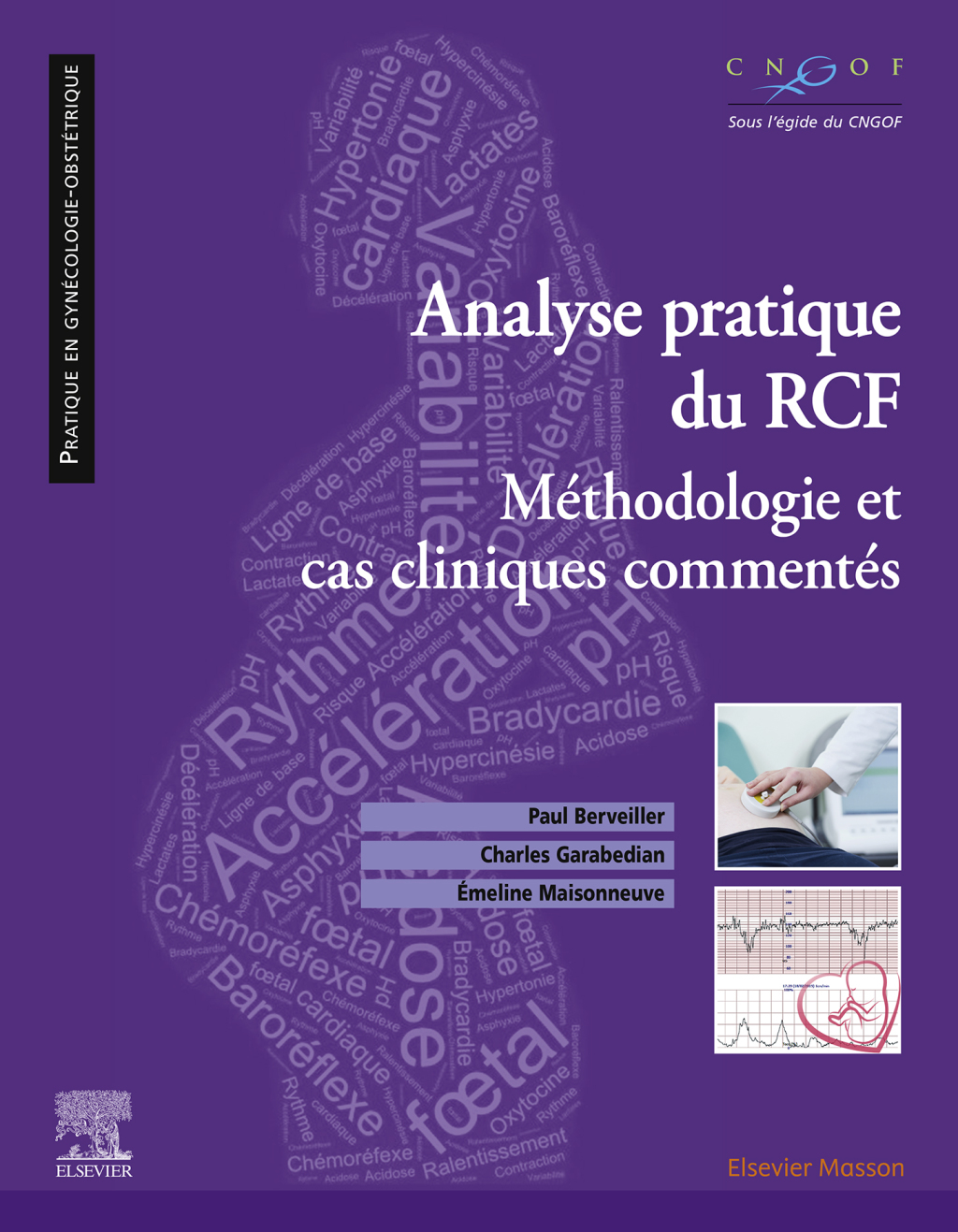Analyse pratique  du RCF : rythme cardiaque foetal Méthodologie et cas cliniques commentés