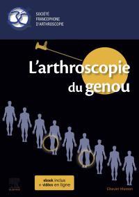 Cover image: L'arthroscopie du genou 1st edition 9782294766657