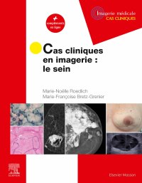 Imagen de portada: Cas cliniques en imagerie : le sein 9782294769276