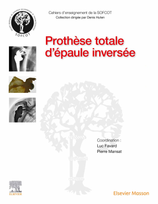 Cover image: Prothèse totale d'épaule inversée 9782294765919
