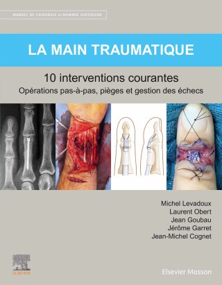 Imagen de portada: La main traumatique 10 interventions courantes 9782294769245