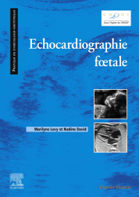 Omslagafbeelding: Echocardiographie fœtale 9782294770609