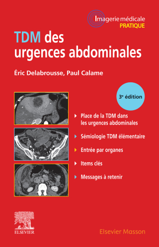 Titelbild: TDM des urgences abdominales 3rd edition 9782294770852
