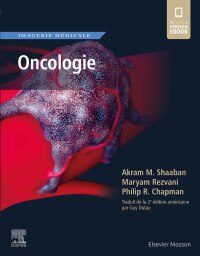 Cover image: Imagerie médicale : Oncologie 9782294770999