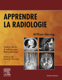 Cover image: Apprendre la radiologie 9782294771491