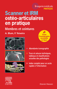 Cover image: Scanner et IRM ostéo-articulaires en pratique 9782294762857