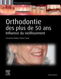 Cover image: Orthodontie des plus de 50 ans 1st edition 9782294773204