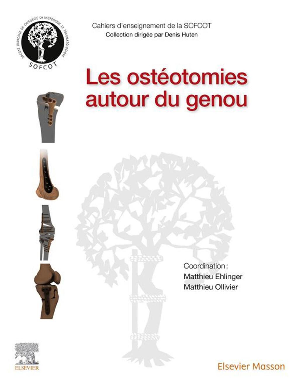 Les ostéotomies autour du genou