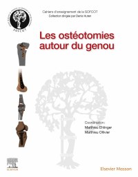 Cover image: Les ostéotomies autour du genou 9782294773648