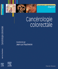 Immagine di copertina: Cancérologie colorectale 9782294774546