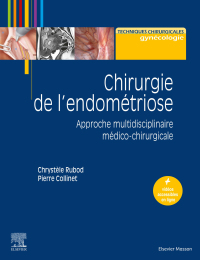 Cover image: Chirurgie de l'endométriose 9782294774270