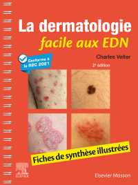 Cover image: La dermatologie facile aux EDN 2nd edition 9782294775185