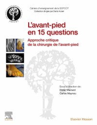 Imagen de portada: L'avant-pied en 15 questions 1st edition 9782294775635