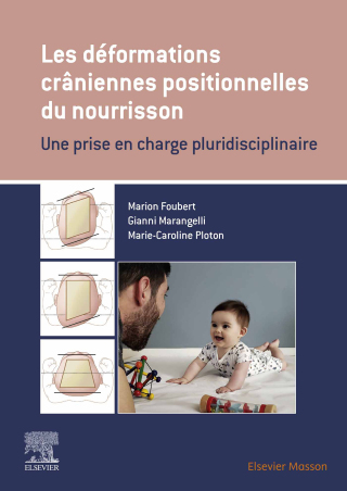 Cover image: Les déformations crâniennes positionnelles du nourrisson 9782294776137