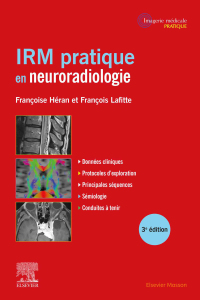 Immagine di copertina: IRM pratique en neuroradiologie 3rd edition 9782294777646