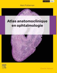 Cover image: Atlas anatomoclinique en ophtalmologie 1st edition 9782294773174