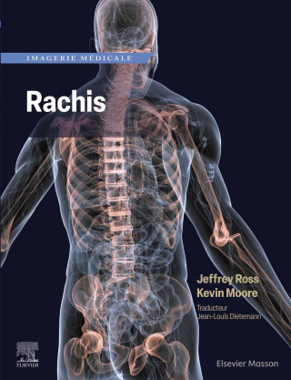 Imagen de portada: Imagerie médicale : Rachis 1st edition 9782294779282