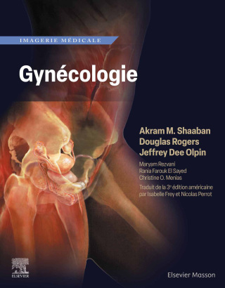 Cover image: Imagerie médicale : Gynécologie 1st edition 9782294779954
