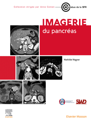表紙画像: Imagerie du pancréas 1st edition 9782294780219