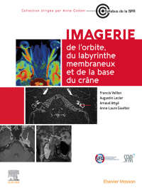 Cover image: Imagerie de l’orbite, du labyrinthe membraneux et de la base du crâne 1st edition 9782294780226