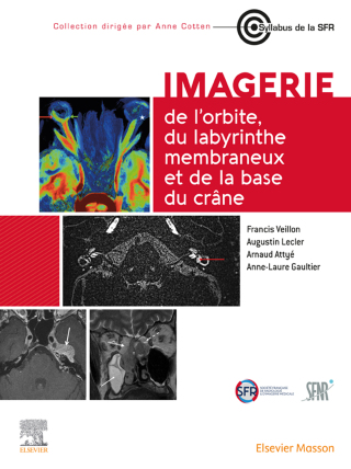 Cover image: Imagerie de l’orbite, du labyrinthe membraneux et de la base du crâne 1st edition 9782294780226