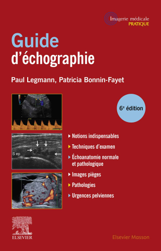Cover image: Guide pratique d'échographie 6th edition 9782294780424