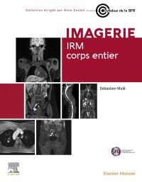 Imagen de portada: IRM corps entier 1st edition 9782294781896