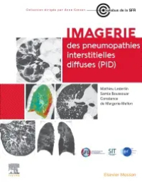 صورة الغلاف: Imagerie des pneumopathies interstitielles diffuses (PID) 1st edition 9782294781902